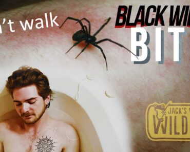 Black Widow BITE!! Try To SURVIVE