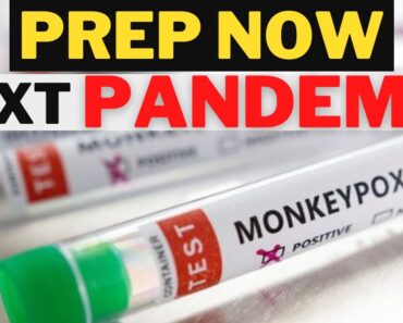 The NEXT Pandemic? | Monkeypox | Prep Now | Monkeypox Outbreak | SHTF